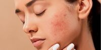 7 نشانه روی پوست که خبر از بیماری می دهند