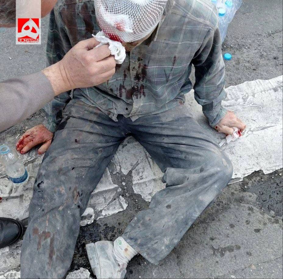 تصویر نخستین مجروح حمله امروز اسرائیل به ایران | عکس