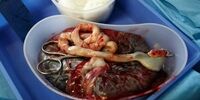 یک سوال مهم؛ کرونا از مادر به جنین منتقل می شود؟