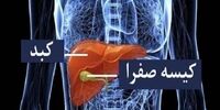 مهم ترین علائم سنگ کیسه صفرا را بشناسید