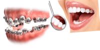 آیا کشیدن دندان برای درمان ارتودنسی ضروری است؟