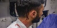 حمله با چاقو به کارشناس اورژانس حین امدادرسانی
