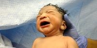 تولد نوزاد عجیب الخلقه با یک دم خبرساز شد! + عکس