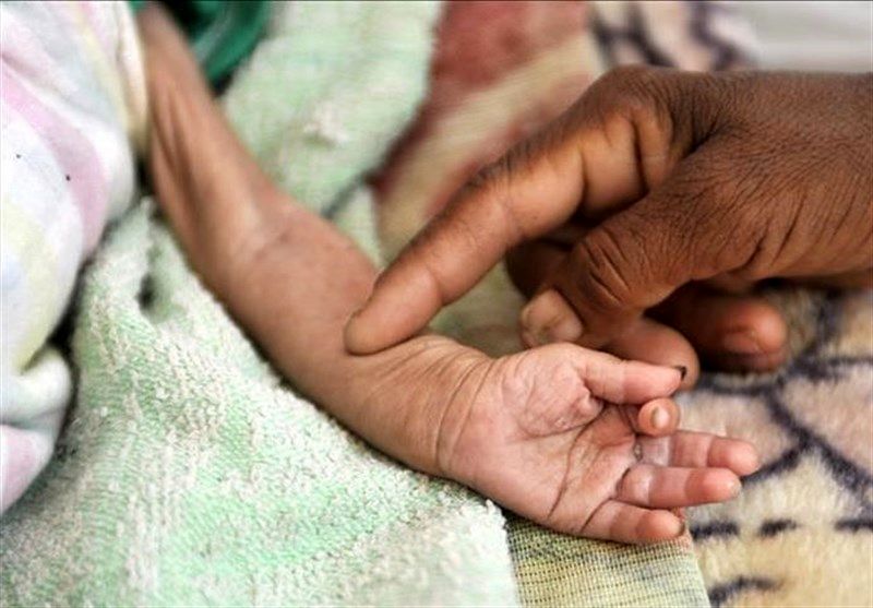 بحران سوءتغذیه کودکان در کشور/ 5 استان رکورددار را بشناسید