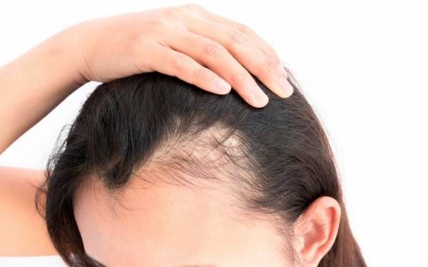 ریزش موی خود را با این روش درمان کنید