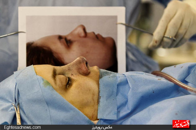 جراحی بینی در ایران از دریچه دوربین رویترز (گزارش تصویری)