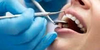 اگر مراقب دندان‌هایتان نباشید، آلزایمر می گیرید!