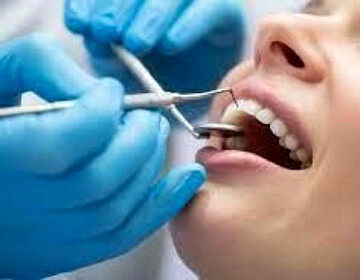 اگر مراقب دندان‌هایتان نباشید، آلزایمر می گیرید!