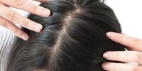 این مواد غذایی سرعت ریزش موهای شما را چند برابر می‌کند!