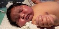 تولد نوزاد 6 و نیم کیلویی در مشهد+عکس