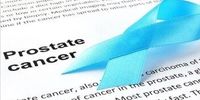 شایع‌ترین سرطان در میان مردان چیست؟ / عوامل کاهش خطر ابتلا را بشناسید