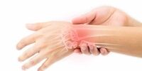 علائم در رفتگی مچ دست چیست؟ راهکارهای درمانی