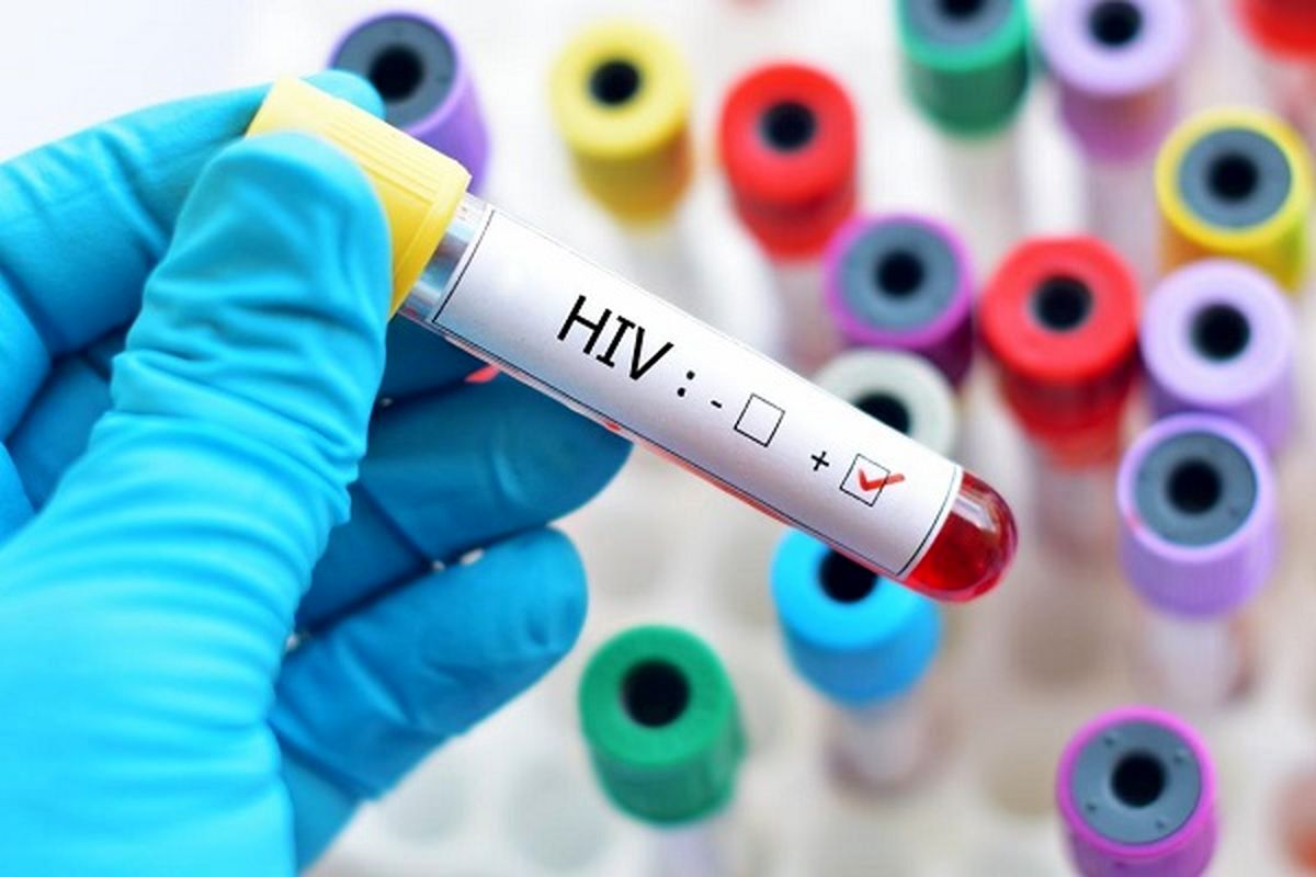 آخرین وضعیت HIV در کشور مشخص شد / راه های انتقال ایذر 