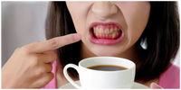 بلایی که نوشابه و قهوه بر سر دندان هایتان می آورد