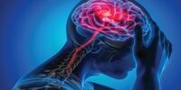  علائم هشدار دهنده سکته در سنین مختلف 