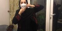 کج شدن فک بازیگر مشهور
