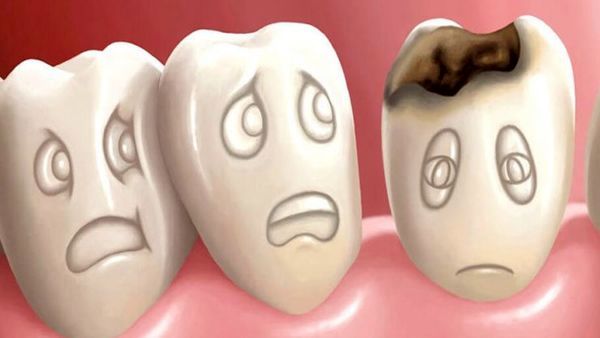 این خوراکی‌ها دندان هایتان را نابود می‌کنند
