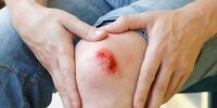 جای زخم را چه طور از بین ببریم؟