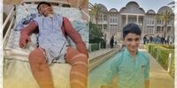جزئیات مهم از فوت «علی لندی» به روایت پزشک معالج