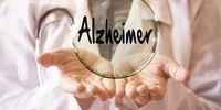 کشف راهی ارزان و ساده برای تشخیص زودهنگام آلزایمر 