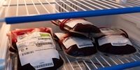 یک گروه خونی بسیار نادر که تنها ۴۳ نفر در جهان آن را دارند!