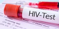 3 راه انتقال HIV/ اولین کار ویروس ایدز بعد از ورود به بدن

