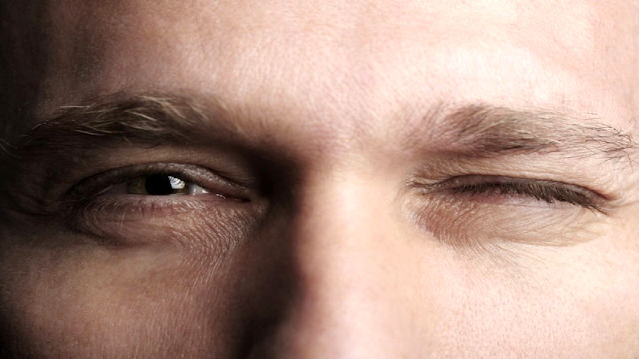 پریدن چشم نشانه کمبود این مواد در بدن است 