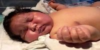 تولد یک نوزاد دختر با دُم 12 سانتیمتری + عکس
