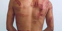 حال و روز یک عکاس پس از آزادی از دست طالبان+عکس