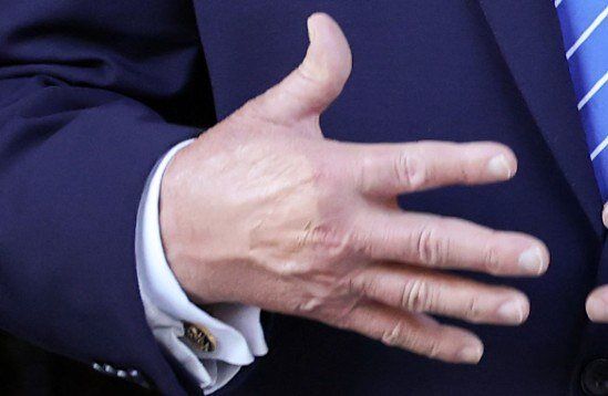 دست سیاه ترامپ امروز رنگ‌آمیزی شد. 