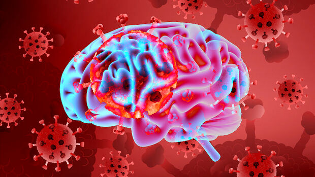 اثر تازه وخطرناک کرونا بر مغز انسان 