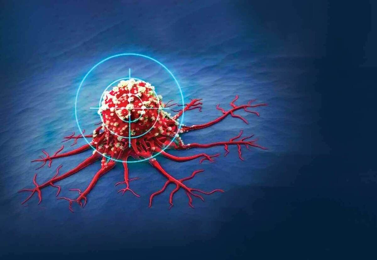 محدودیت غذایی؛ رنج مضاعف بیماران PKU
