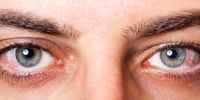 اگر در چشمتان رگه های خونی دارید به این بیماری خطرناک دچار شده اید 