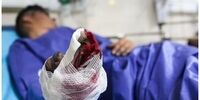 چهارشنبه سوری در این استان منجر به چند قطع عضو شد