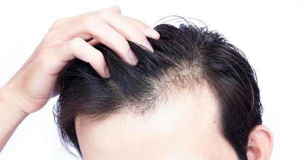 ​۵ ترفند برای داشتن موهای سالم