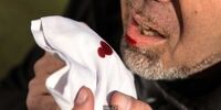 سازمان بهداشت جهانی خبرداد؛اثرجدیدوخطرناک کرونا!
