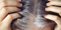 چگونه از سفید شدن موها جلوگیری کنیم؟
