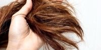 راهکارهای طب سنتی برای جلوگیری از ریزش مو