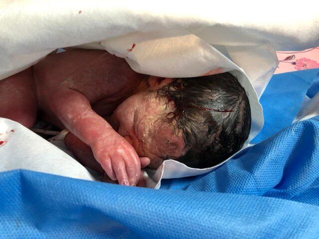 تولد نوزاد سالم از مادر کرونایی در بحرانی‌ترین بیمارستان کشور