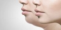راهکاری باورنکردنی برای از بین بردن غبغب
