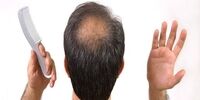 اگر موهای کم حجم دارید این ۷ اشتباه را مرتکب نشوید

