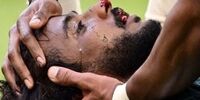اتفاق وحشتناک در بازی های جام جهانی/ جمجمه بازیکن عربستان خرد شد+ عکس