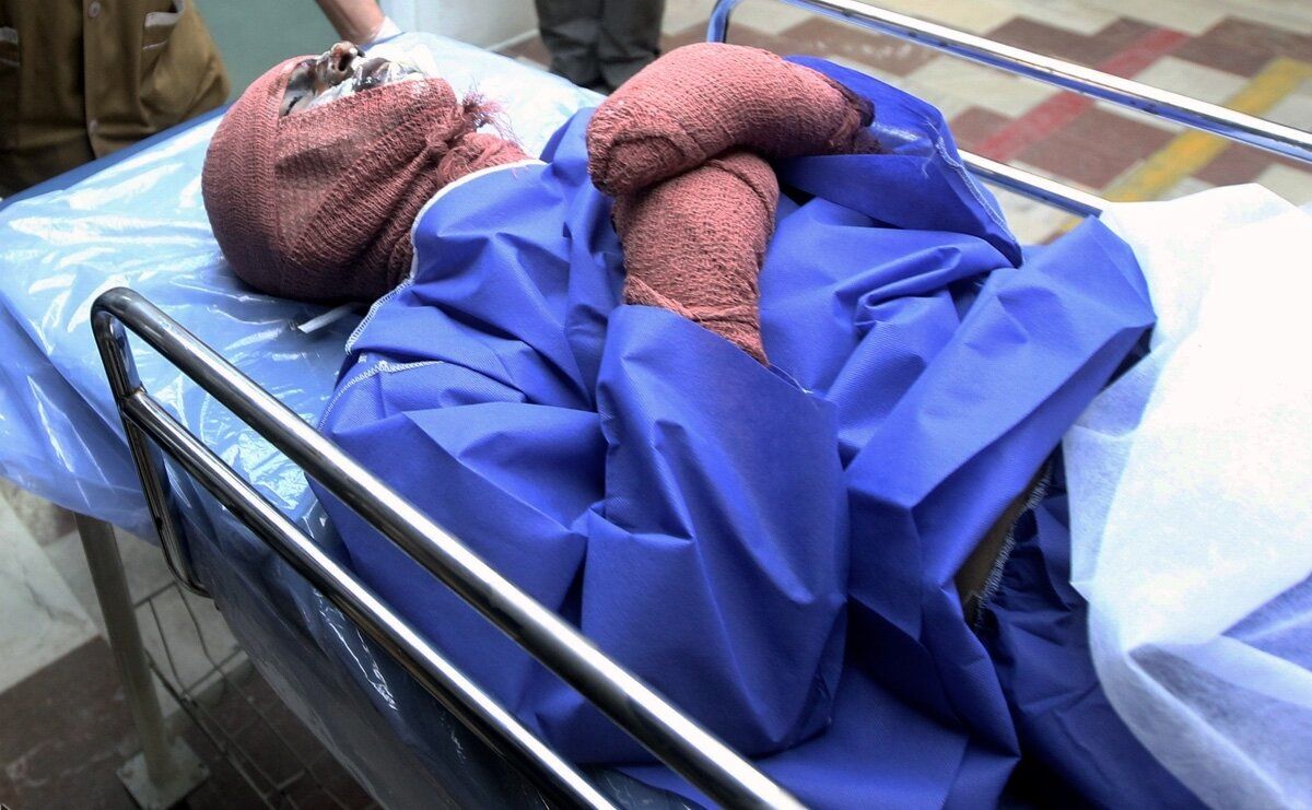 اسیدپاشی عجیب یک روی مرد جوان و دختر ۱۱ ساله‌اش/ او مدام تخم‌مرغ، سنگ و آشغال از پنجره خانه‌اش به‌ سمت رهگذران پرت می کرد
