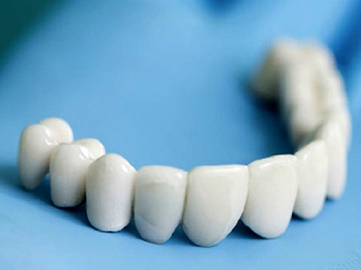 اثر خرابی دندان بر زوال عقل