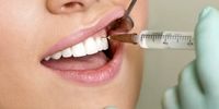 از زیاد مسواک زدن تا دهان شویه/ ده نکته مهم درباره بهداشت دندان‌ها