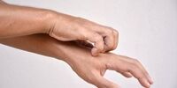 این علائم جدید کرونا روی پوست ظاهر می‌شود


