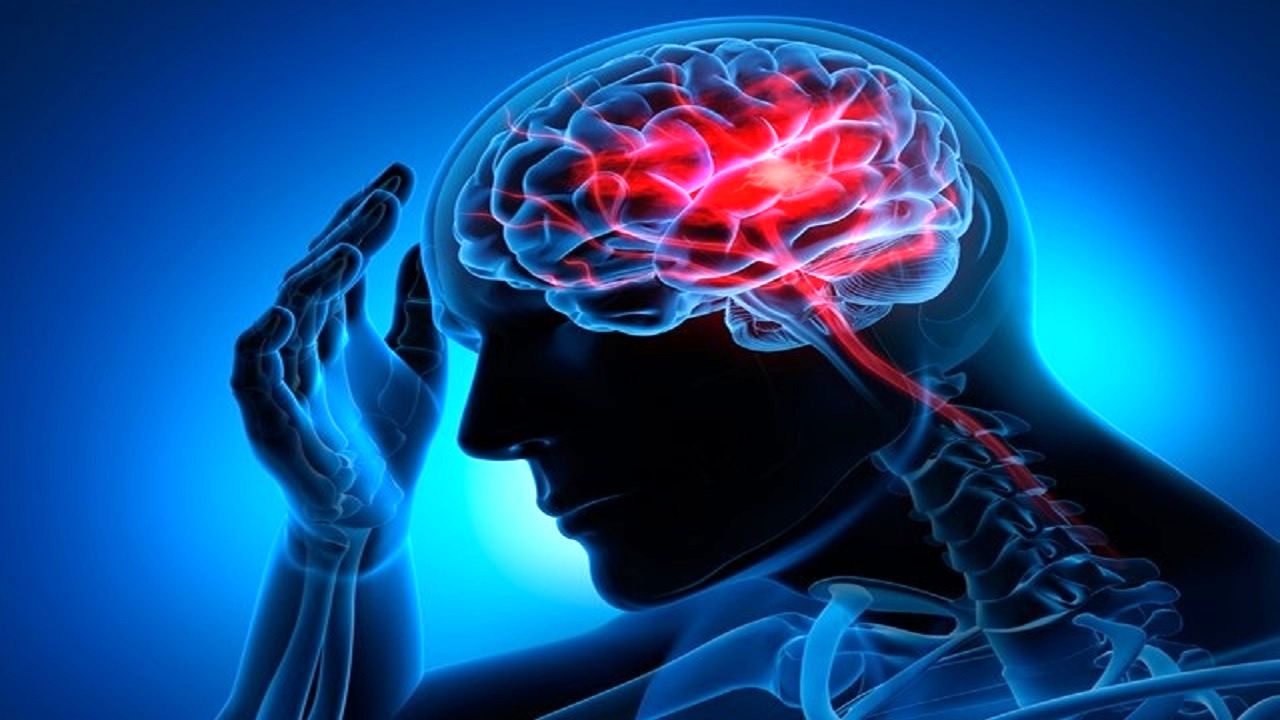 پنج علامت بدن قبل از سکته مغزی را بشناسید