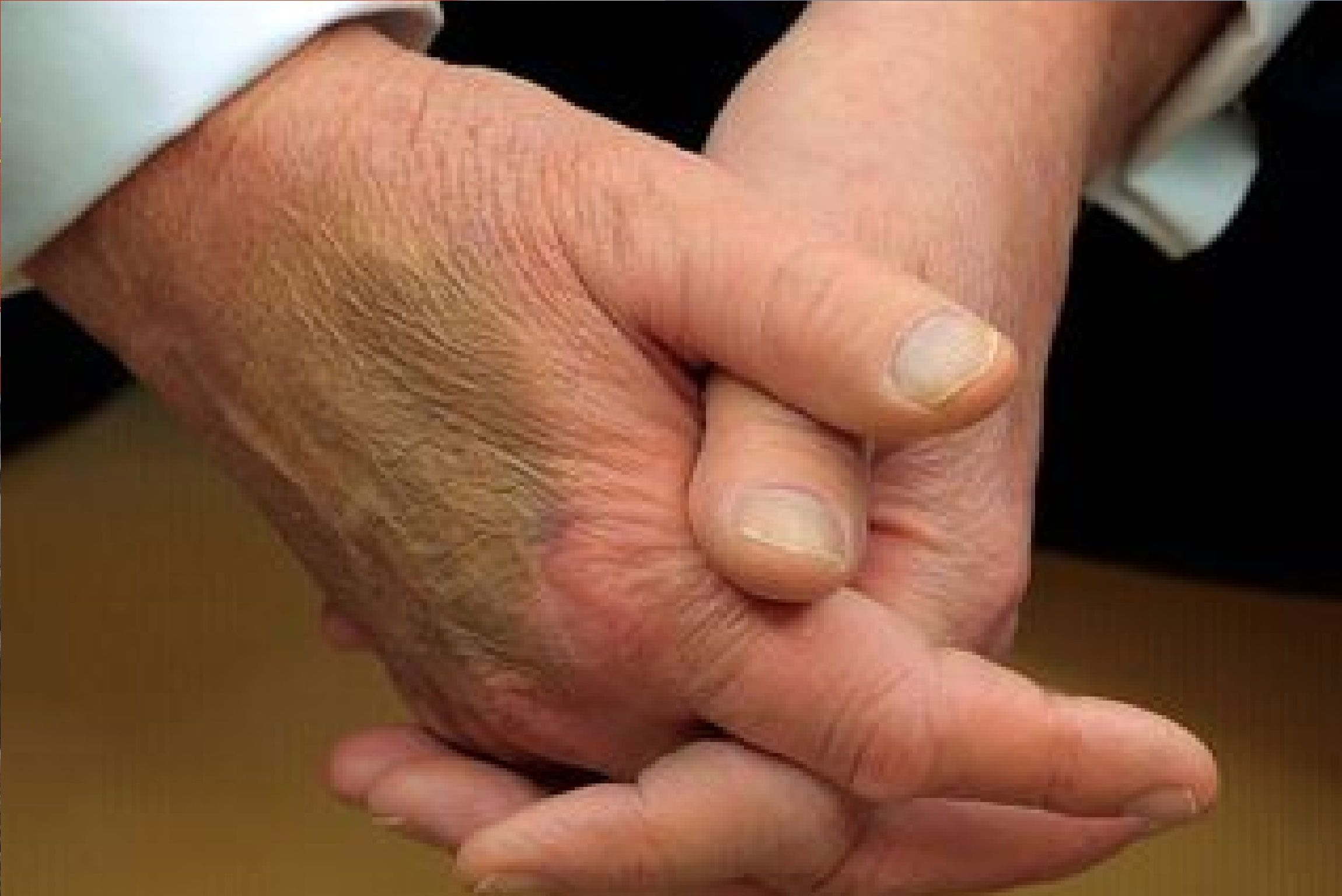 تلاش ترامپ برای پنهان کردن کبودی دست راستش شکار دوربین‌ها شد