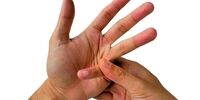 شکستن قولنج چه زمانی خطرناک است؟
