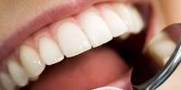 ورزش بر سلامت دندان‌ها تاثیر منفی می‌گذارد!